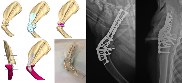 Custom implant design & manufacture - Case 2