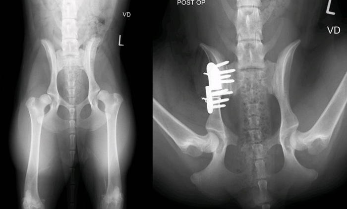 Double Pelvic Osteotomy