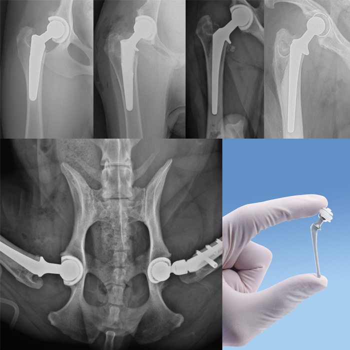 We are experienced in the placement of cementless, cementless hooked stem, hybrid and cementess hip replacement