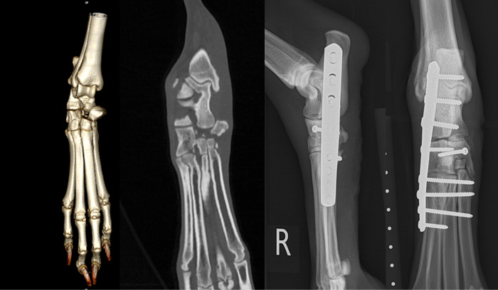  Partial tarsal arthrodesis due to multiple tarsal bone fracture / luxation 